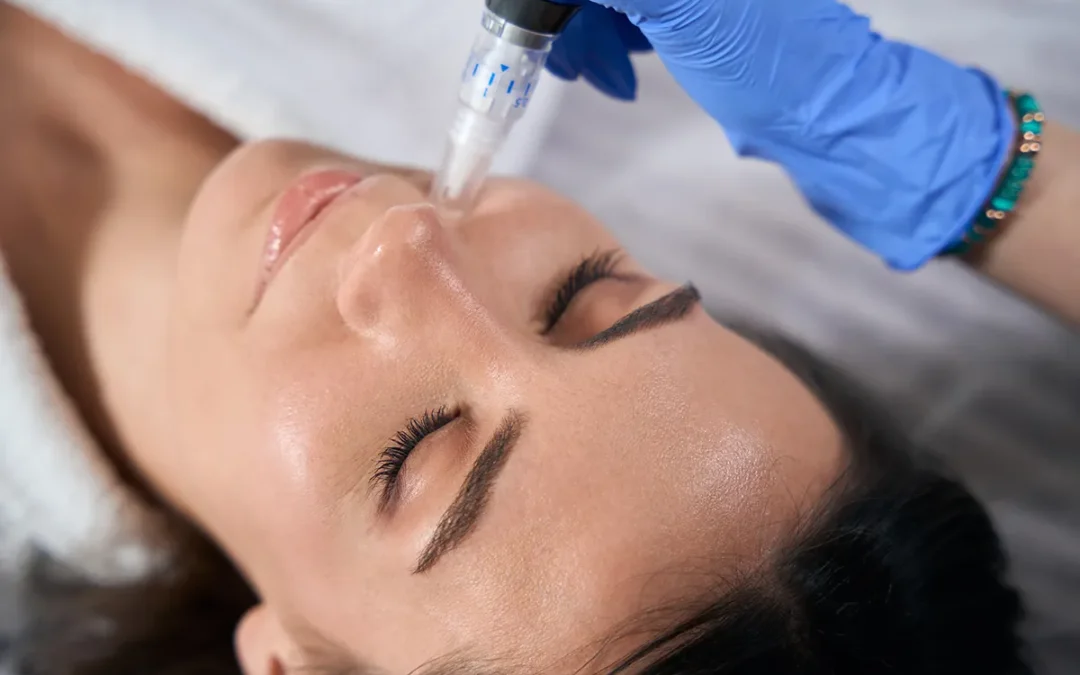 Réjuvapen: How To Remove Acne Scars & Micro Needling Treatments