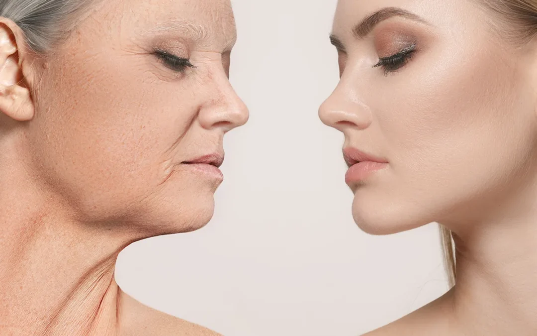 Facial Volume Loss: What’s Your Facial Aging Type?