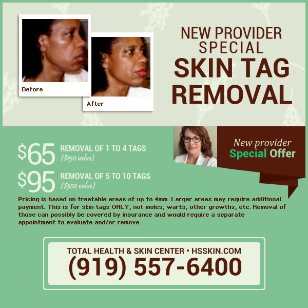 skin tag removal specials
