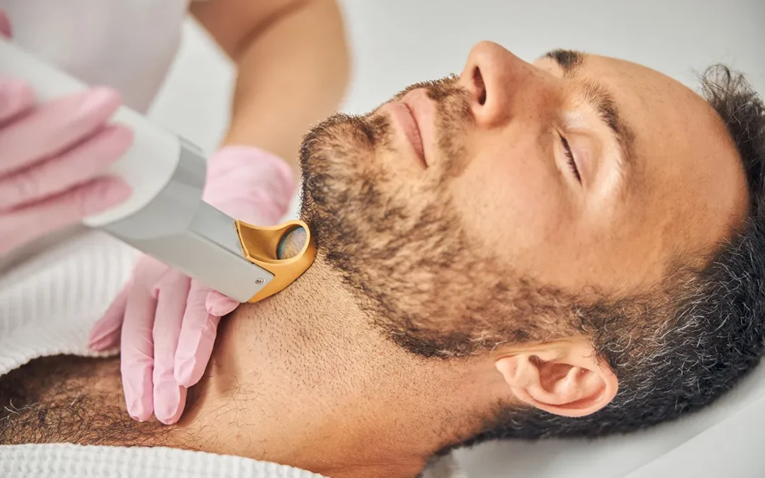 How Much Do You Know About Laser Hair Removal?