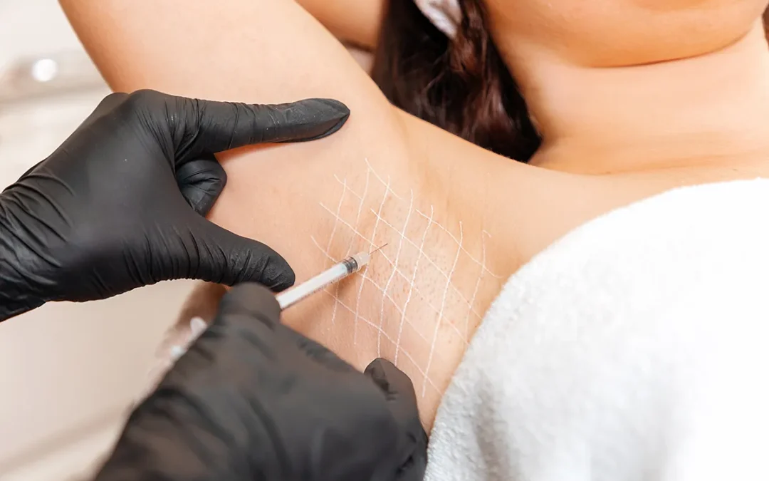 Don’t Let Excessive Underarm Sweating Diminish Your Life
