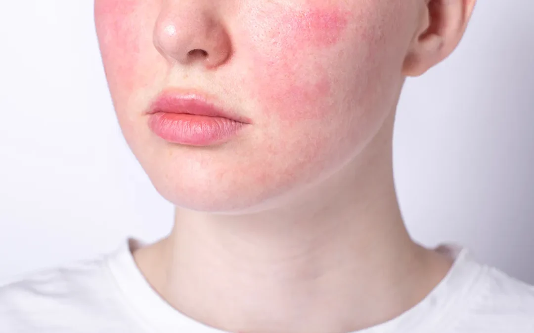 Do You Have Sensitive Skin?