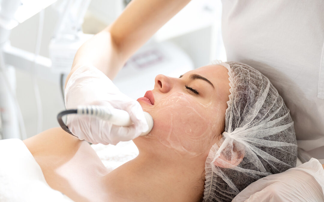 Preparing For Laser Acne Scar Removal