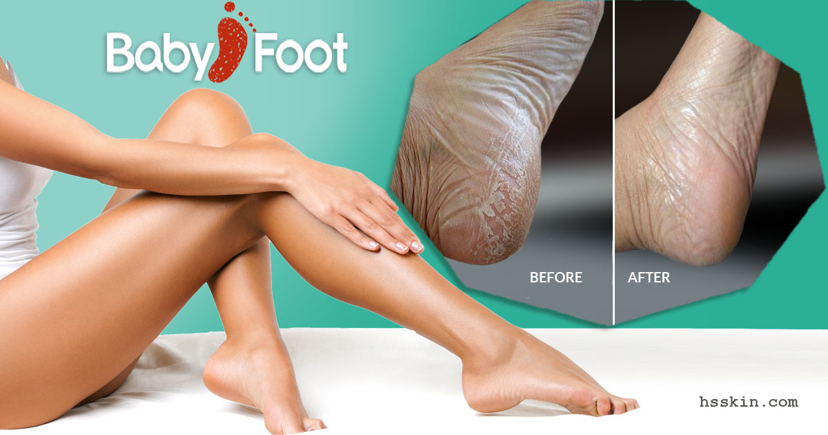Baby Foot Exfoliating Foot Peel - Thrive Skin + Wellness