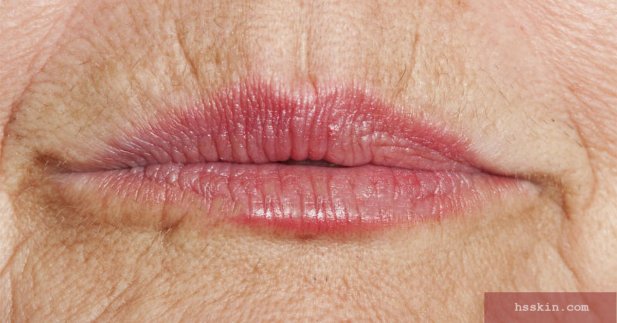 Do Straws Cause Lip Lines And Wrinkles? Top Derms Give Us The Answer